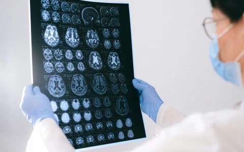 INSIDE CTAD 2025: WHAT'S NEXT FOR ALZHEIMER'S RESEARCH