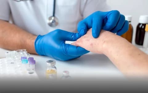 CAN JAK INHIBITORS DETHRONE TOPICAL STEROIDS?